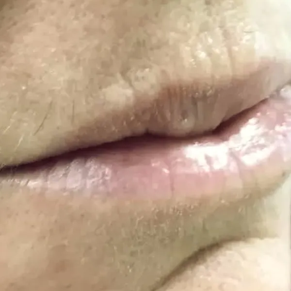 Permanent Make-Up – Before