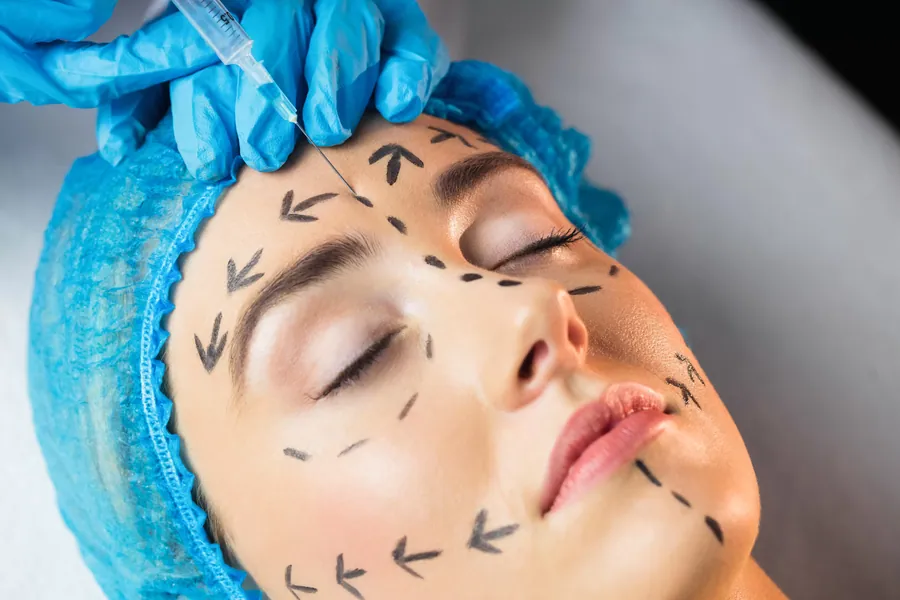Endopeel