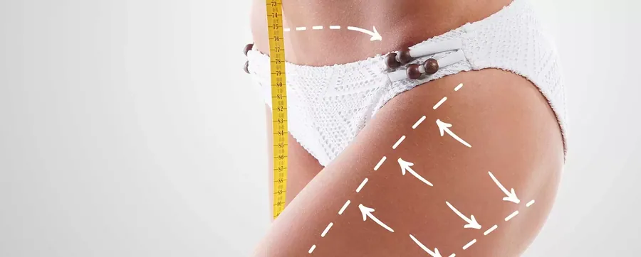 Injection Lipolysis