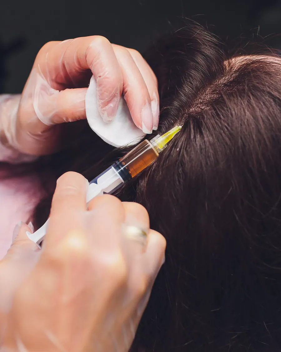 Hair Mesotherapy