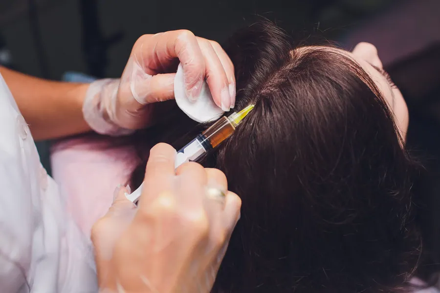 Hair Mesotherapy