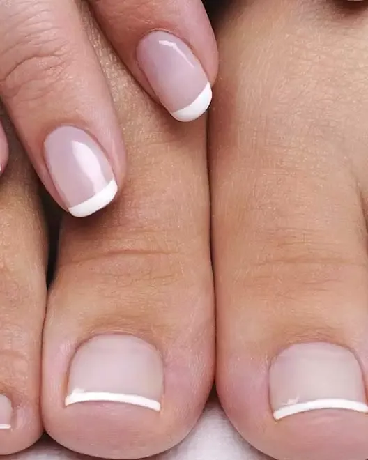Nail Fungus Treatment