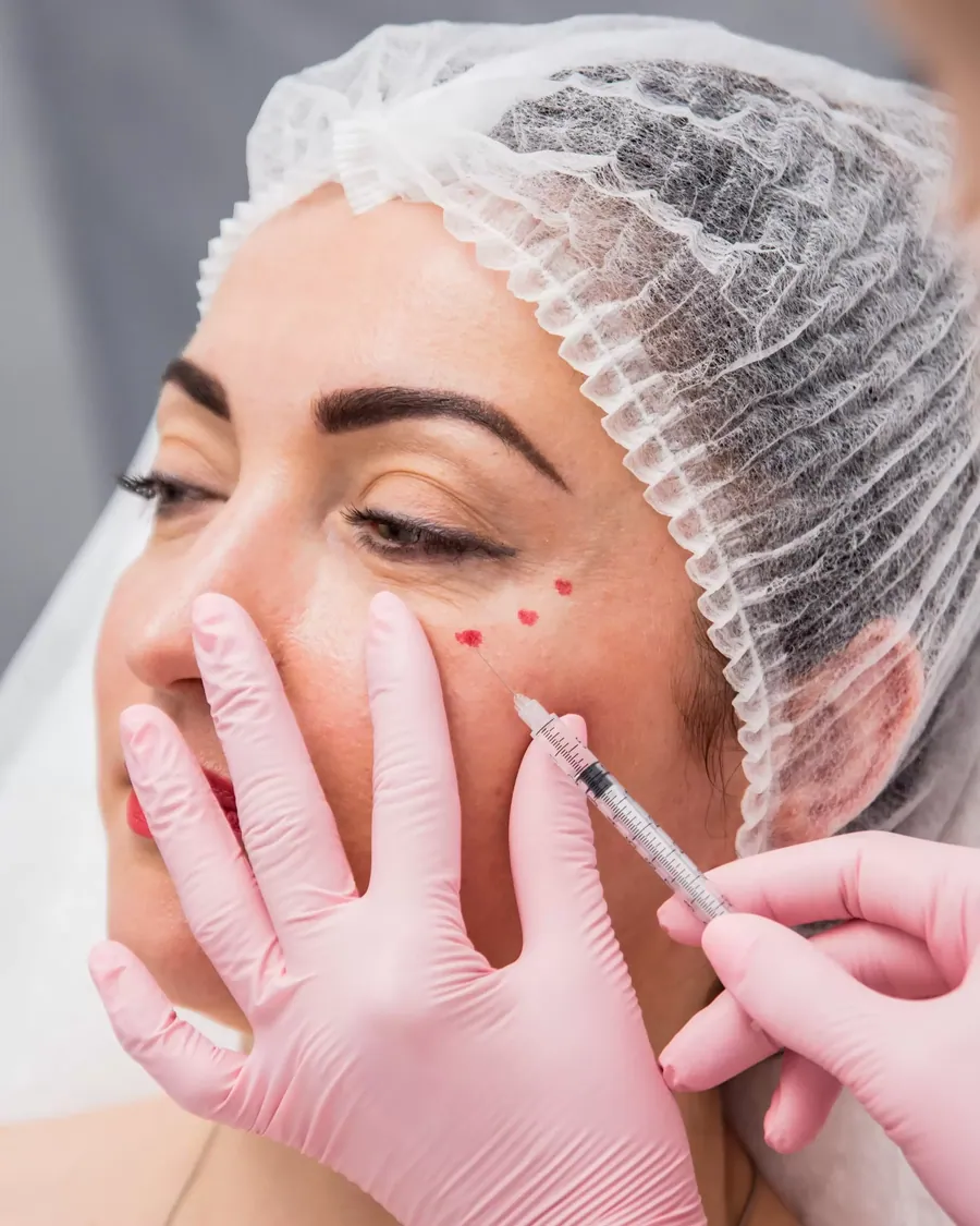 Dermal Fillers