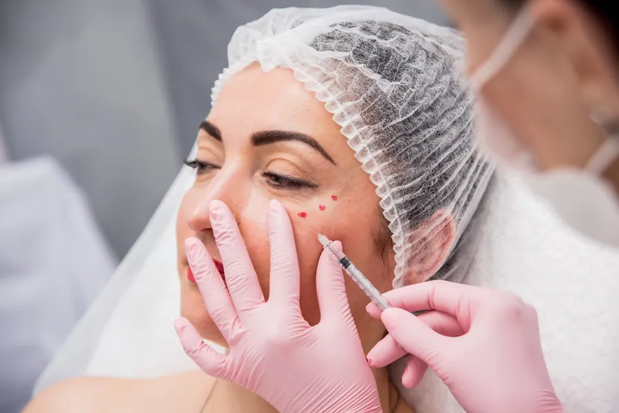 Dermal Fillers